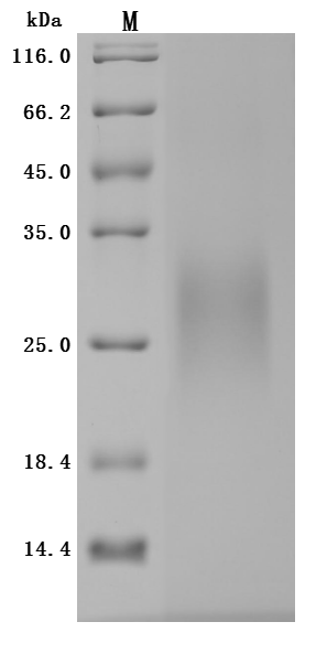 Recombinant Human IGF-like family receptor 1 (IGFLR1), partial (Active)