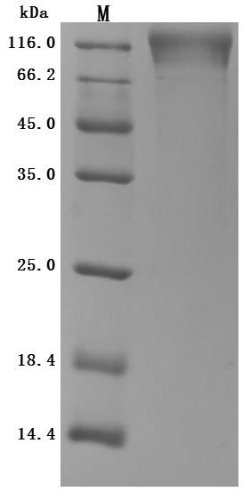 Recombinant Human T-cell surface protein tactile (CD96), partial (Active)