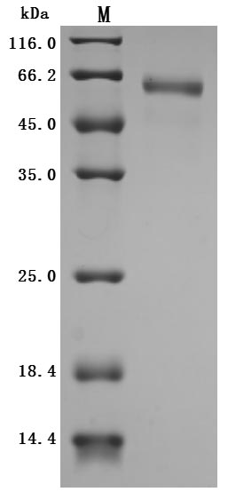 Recombinant Human Cytokine receptor common subunit beta (CSF2RB), partial (Active)