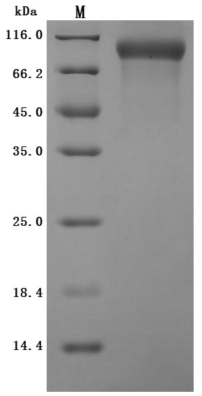 Recombinant Human Poliovirus receptor (PVR) (I340M), partial (Active)