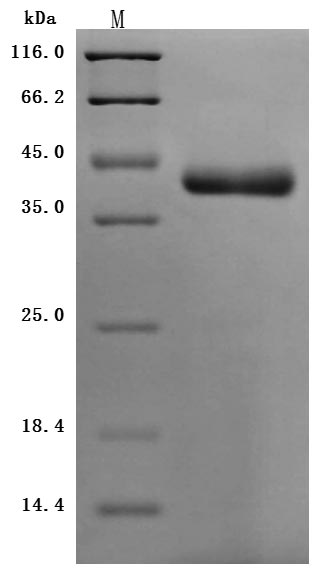 Recombinant Human Nectin-4 (NECTIN4), partial (Active)
