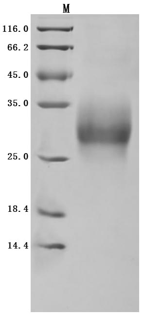 Recombinant Human Tumor necrosis factor receptor superfamily member 9 (TNFRSF9), partial (Active)