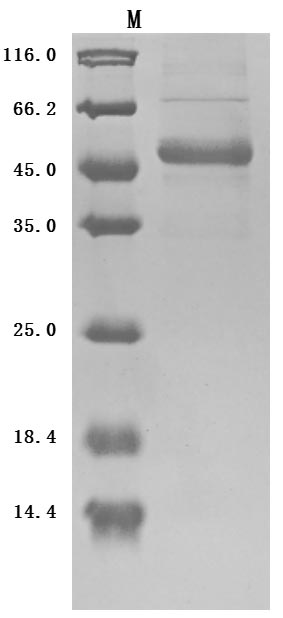 Recombinant Human Tumor necrosis factor ligand superfamily member 9 (TNFSF9), partial (Active)