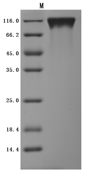 Recombinant Human Tyrosine-protein kinase Mer (MERTK), partial (Active)