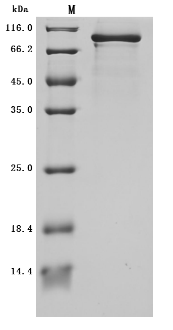 Recombinant Human Plexin-B1 (PLXNB1), partial (Active)