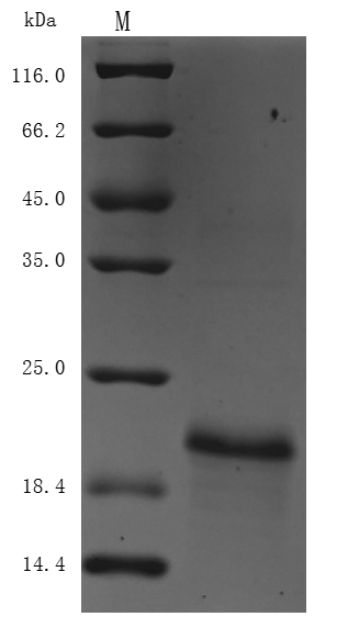 Recombinant Human papillomavirus type 16 Protein E7 (E7) (Active)