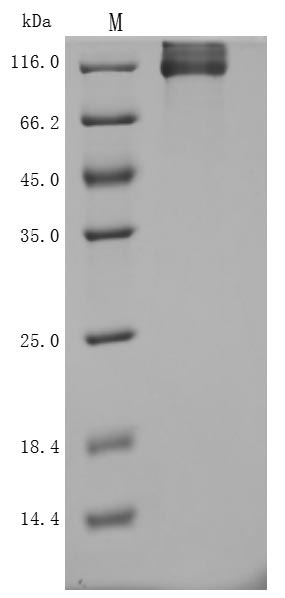 Recombinant Human Neuropilin-1 (NRP1) (Active)