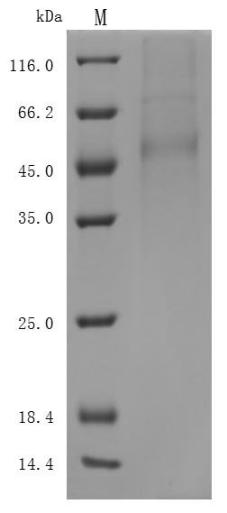 Recombinant Human Delta-like protein 3 (DLL3), partial (Active)