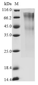 Recombinant Human Glypican-3 (GPC3) (G537R), partial (Active)