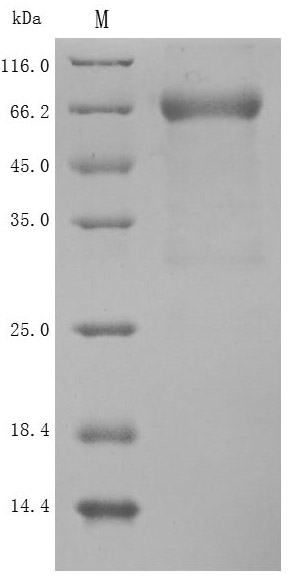 Recombinant Human Semaphorin-4D (SEMA4D), partial (Active)