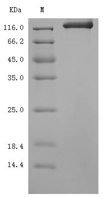Recombinant Mouse Semaphorin-4D (Sema4d), partial (Active)