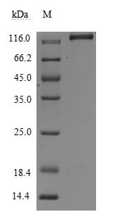 Recombinant Human Leukemia inhibitory factor receptor (LIFR), partial (Active)