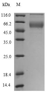 Recombinant Human Tumor necrosis factor ligand superfamily member 8 (TNFSF8), partial (Active)