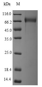 Recombinant Human Tumor necrosis factor receptor superfamily member 8 (TNFRSF8), partial (Active)
