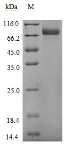 Recombinant Human UL16-binding protein 1 (ULBP1), Biotinylated (Active)