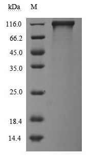 Recombinant Human Receptor tyrosine-protein kinase erbB-3 (ERBB3), partial (Active)