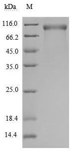 Recombinant Human Receptor tyrosine-protein kinase erbB-2 (ERBB2), partial (Active)