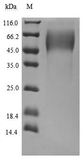 Recombinant Human Mucin-16 (MUC16), partial (Active)