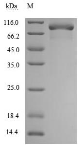 Recombinant Human Tumor necrosis factor receptor superfamily member 11B (TNFRSF11B) (Active)