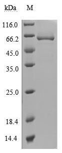 Recombinant Human 5'-nucleotidase (NT5E) (Active)