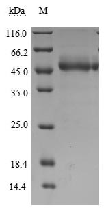 Recombinant Human T-cell immunoreceptor with Ig and ITIM domains (TIGIT), partial (Active)