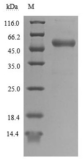 Recombinant Human T-cell antigen CD7 (CD7), partial (Active)