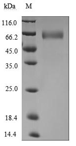 Recombinant Human Basigin (BSG), partial (Active)