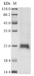 Recombinant Human Cytokine receptor common subunit gamma (IL2RG) (N75Q), partial