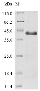 Recombinant Human Interleukin-28 receptor subunit alpha(IFNLR1),partial