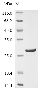 Recombinant Human Collagen alpha-1 (XV) chain (COL15A1), partial