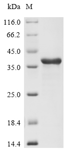 Recombinant Human Non-receptor tyrosine-protein kinase TYK2 (TYK2), partial