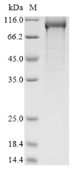 Recombinant Severe acute respiratory syndrome coronavirus 2 Replicase polyprotein 1ab (rep) (P4714L), partial
