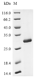 Recombinant Macaca fascicularis Interleukin-2 receptor subunit beta (IL2RB), partial
