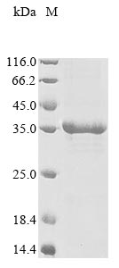 Recombinant Human Ly6/PLAUR domain-containing protein 3 (LYPD3)