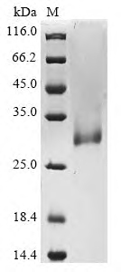 Recombinant Human Tumor necrosis factor ligand superfamily member 11 (TNFSF11), partial