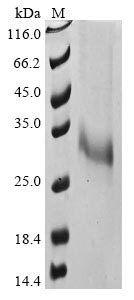 Recombinant Human Tumor necrosis factor ligand superfamily member 11 (TNFSF11), partial (Active)