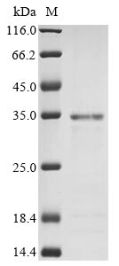 Recombinant Human Non-receptor tyrosine-protein kinase TYK2 (TYK2), partial