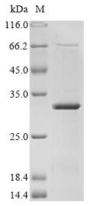 Recombinant Zika virus Genome polyprotein, partial