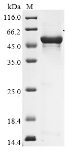 Recombinant Human Hyaluronidase PH-20 (SPAM1)