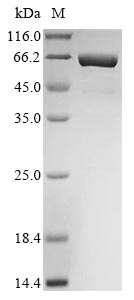 Recombinant Mouse Interleukin-11 (Il11), Biotinylated