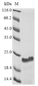 Recombinant Human Heat shock protein HSP 90-alpha (HSP90AA1), partial
