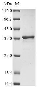Recombinant Human Heat shock protein HSP 90-alpha (HSP90AA1), partial