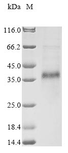 Recombinant Bovine Cathelicidin-1 (CATHL1)