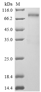 Recombinant Human Syndecan-1 (SDC1)