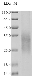 Recombinant Human Triggering receptor expressed on myeloid cells 2 (TREM2), partial (Active)