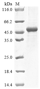 Recombinant Human Collagen alpha-2 (IV) chain (COL4A2), partial