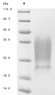 Recombinant Human Homeobox protein Meis1 (MEIS1), partial