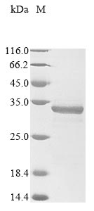 Recombinant Human SLAM family member 7 (SLAMF7), partial