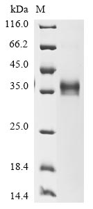Recombinant Mouse Epithelial cell adhesion molecule (Epcam), partial