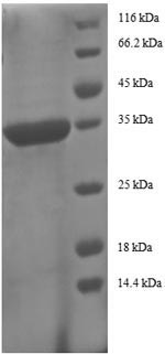 Recombinant Human C-C motif chemokine 5 (CCL5)